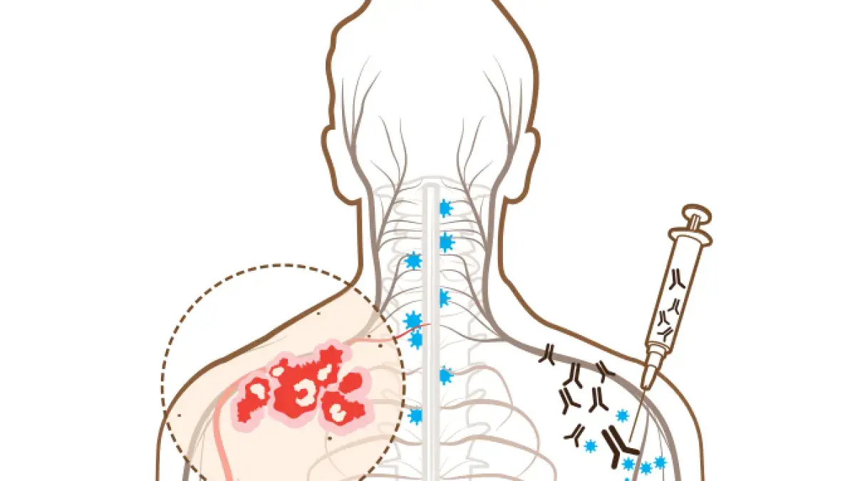 Canetas emagrecedoras aumentam risco de herpes-zóster