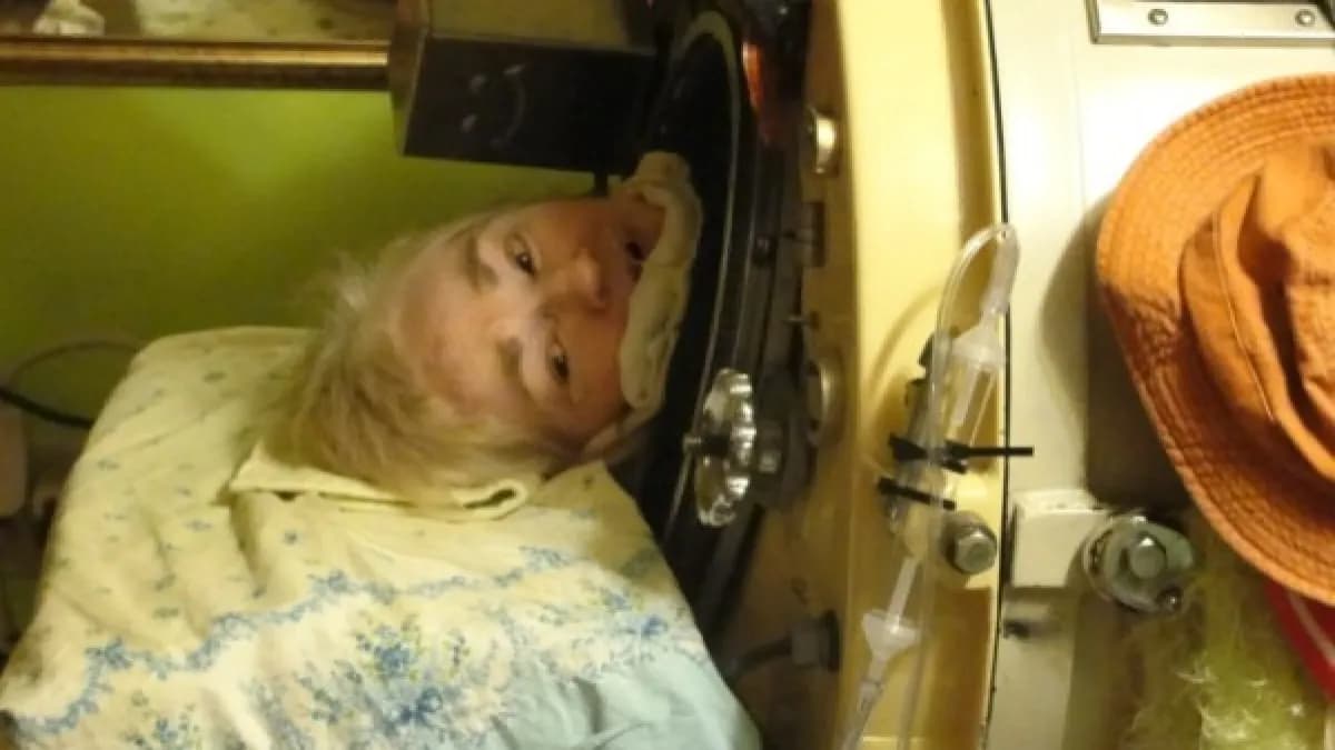 Martha Lillard: última americana em pulmão de aço morre