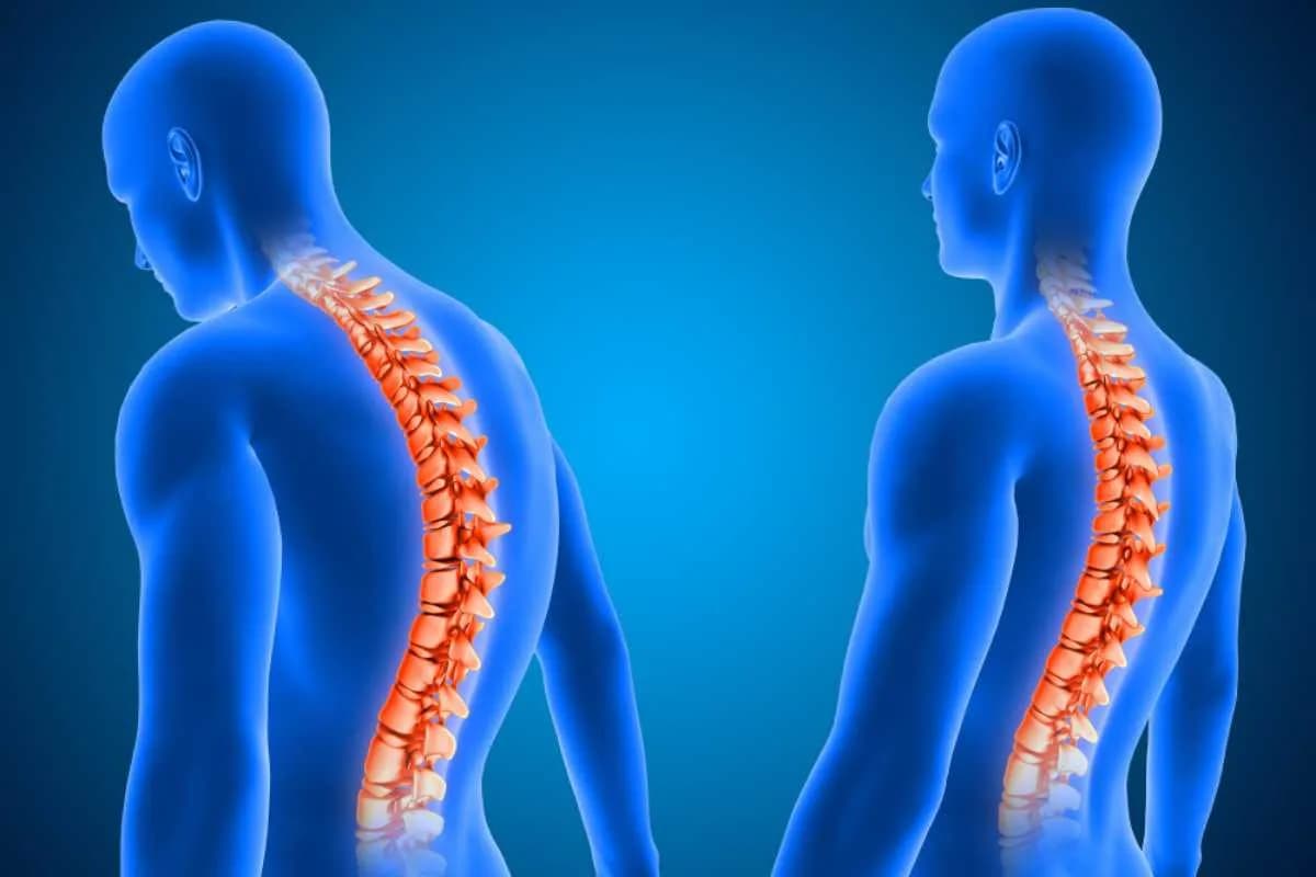 Do Sedentarismo à Cirurgia Robótica: A Nova Era do Tratamento da Coluna Vertebral